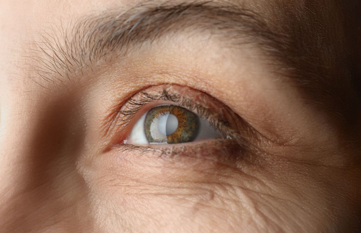 Early Signs of Glaucoma